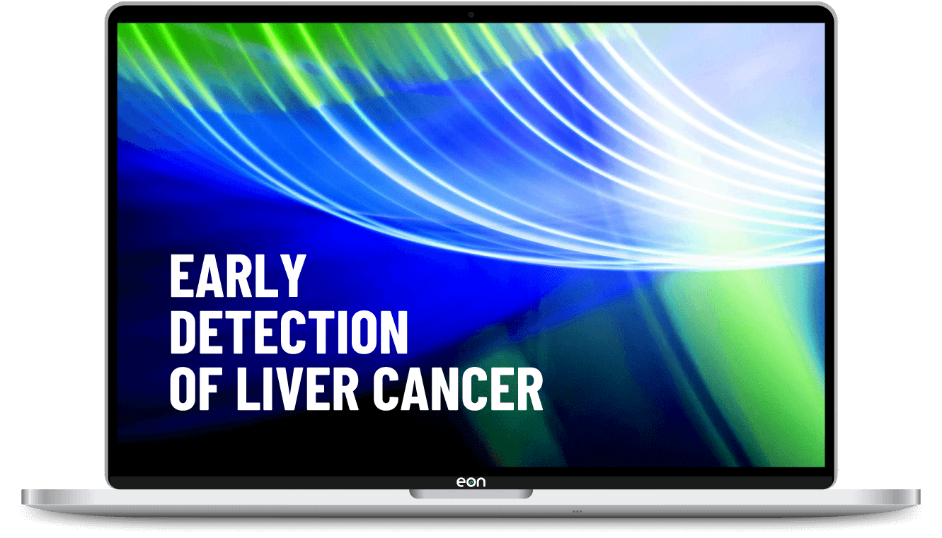 Early Detection of Liver Cancer